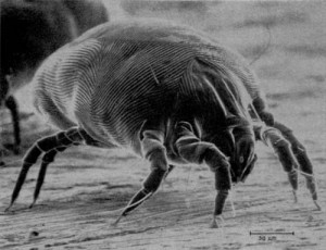 House_Dust_Mite House_Dust_Mite